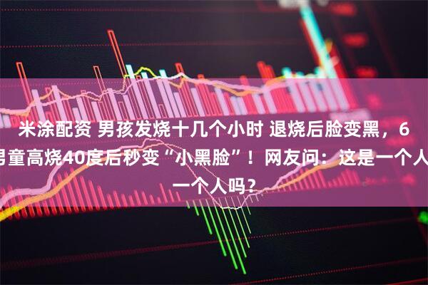 米涂配资 男孩发烧十几个小时 退烧后脸变黑，6岁男童高烧40度后秒变“小黑脸”！网友问：这是一个人吗？
